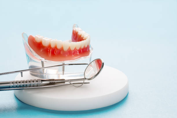 Dental Inlays and Onlays in Crest, CA